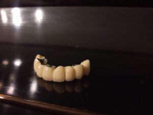 IMG_20221201_233046926