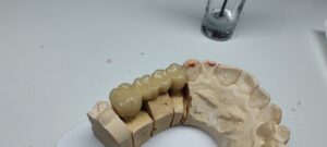 most ceramiczny matealu