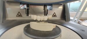 proces wypalania mostu cermicznego