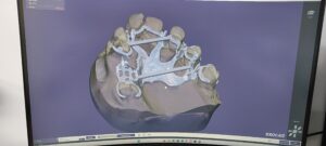 projekt szkieletu 3D 2