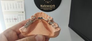 proteza szkieletowa - podbudowa